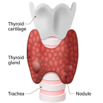 Home Remedies for improving Thyroid Health- Homeoeclinic