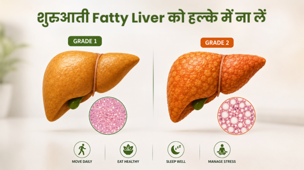 fatty liver symptoms