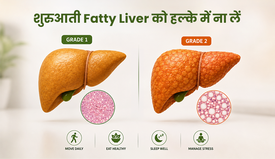 fatty liver symptoms